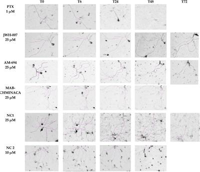 The potential neuroprotective effects of cannabinoids against paclitaxel-induced peripheral neuropathy: in vitro study on neurite outgrowth